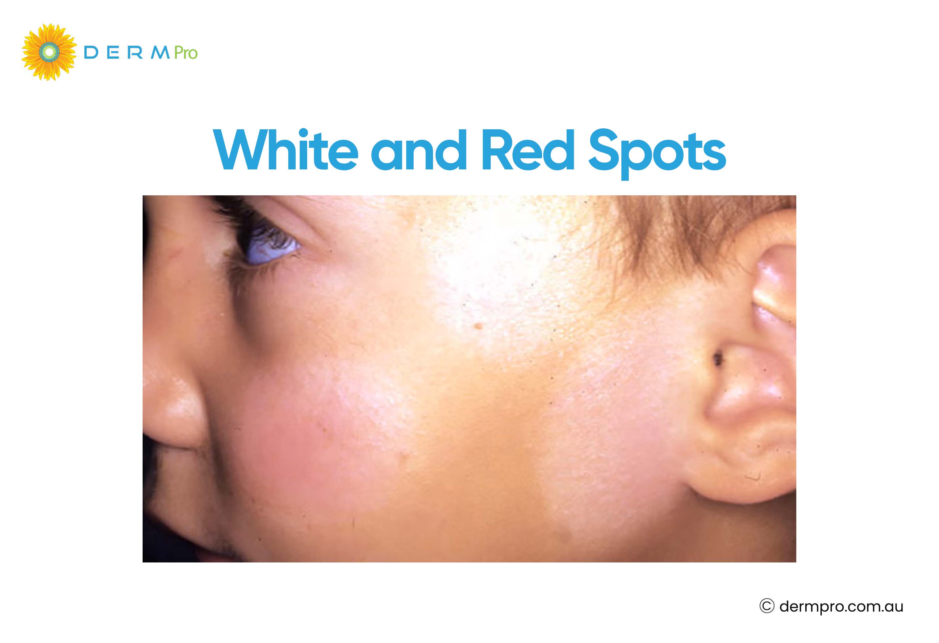 image of white and red spots on skin 