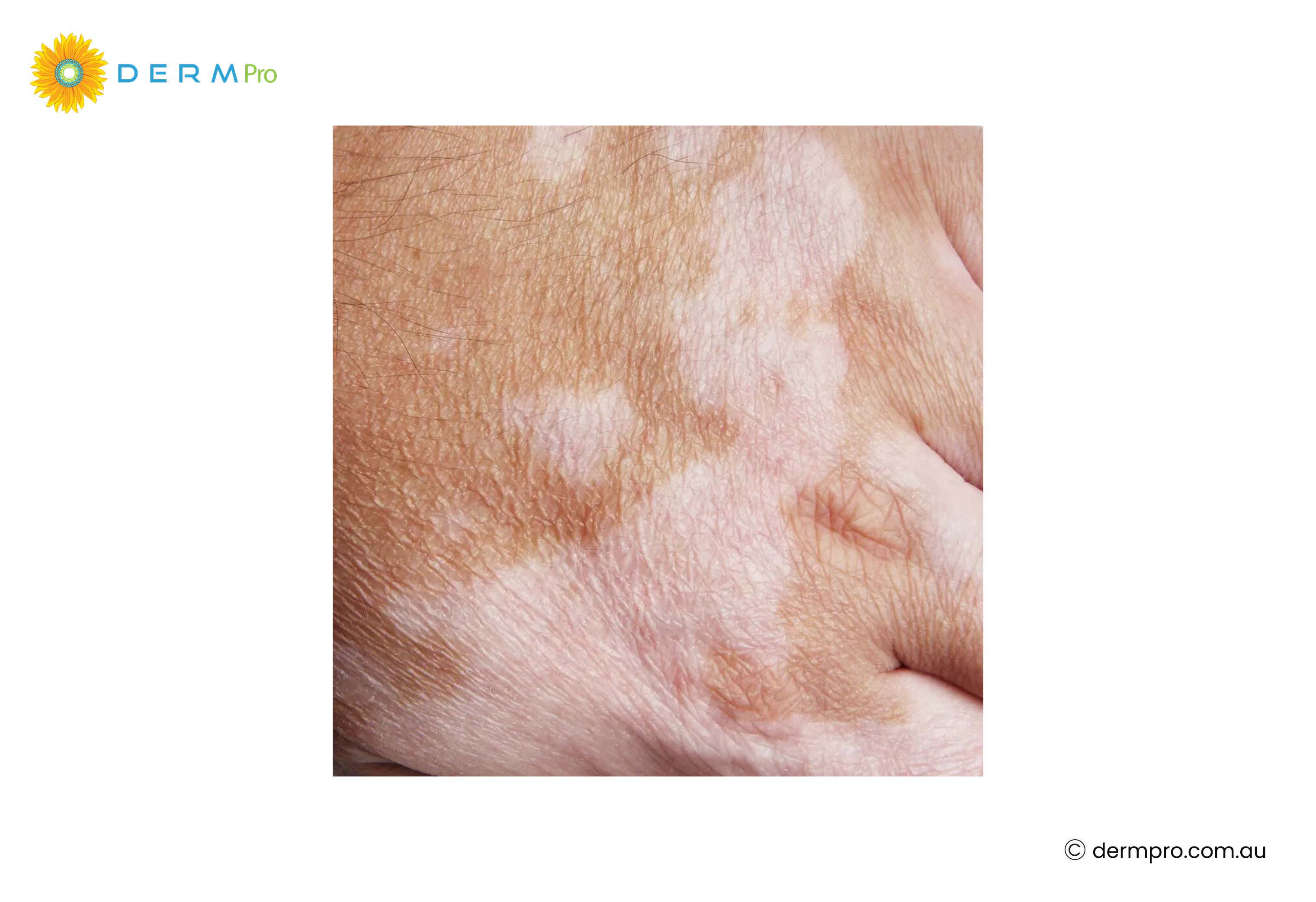 images of white and red spots 