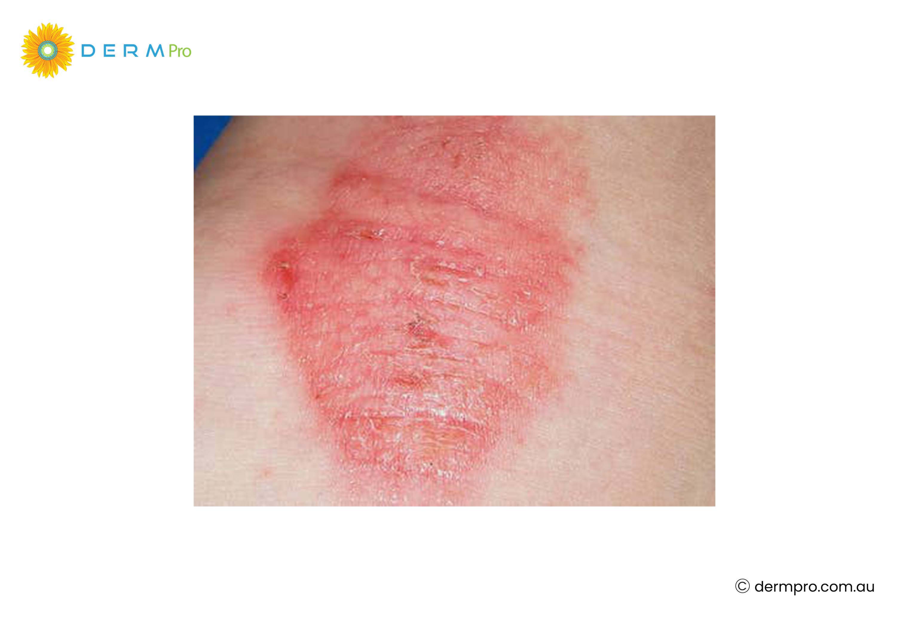 images of white and red spots 