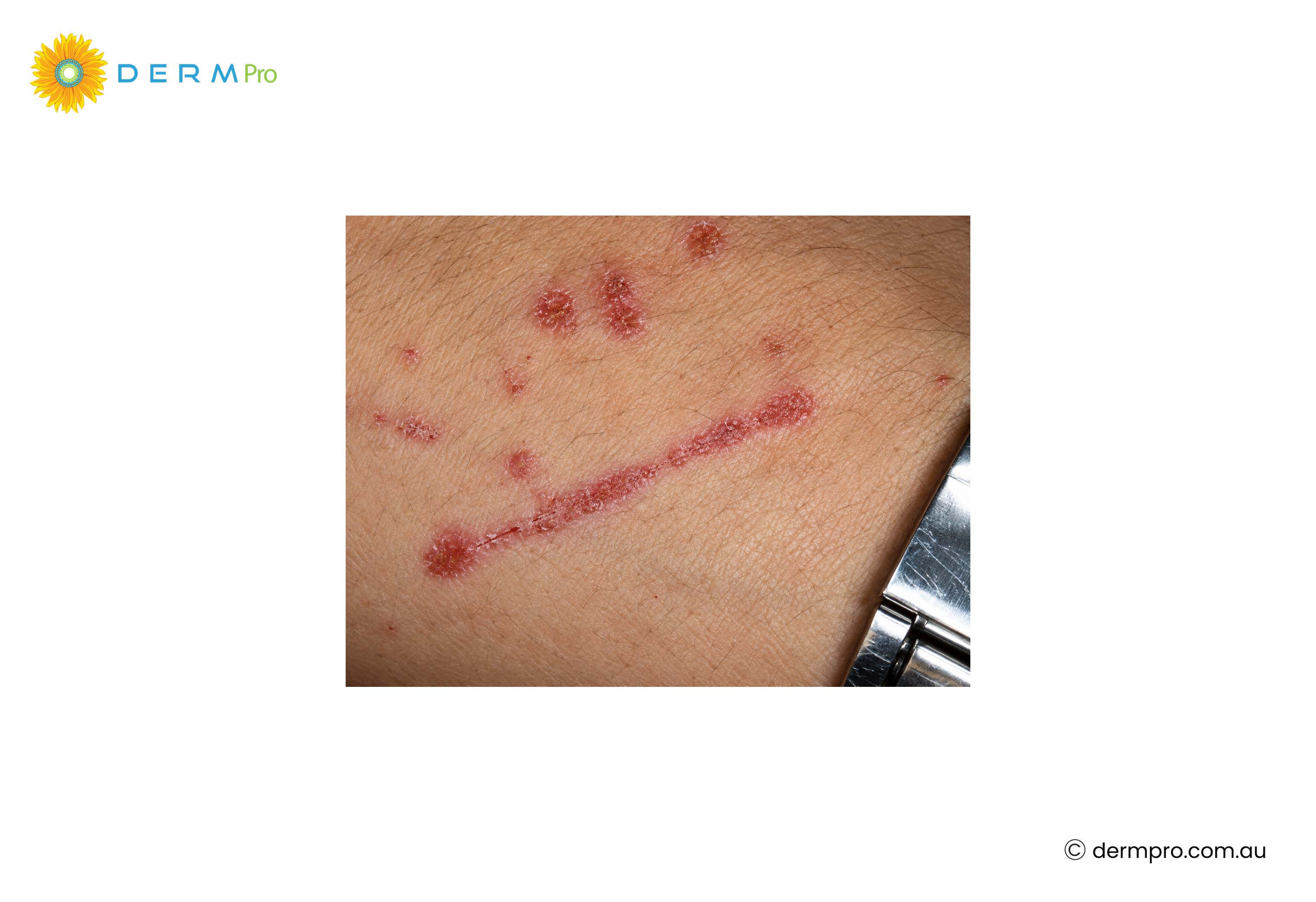 images of white and red spots 