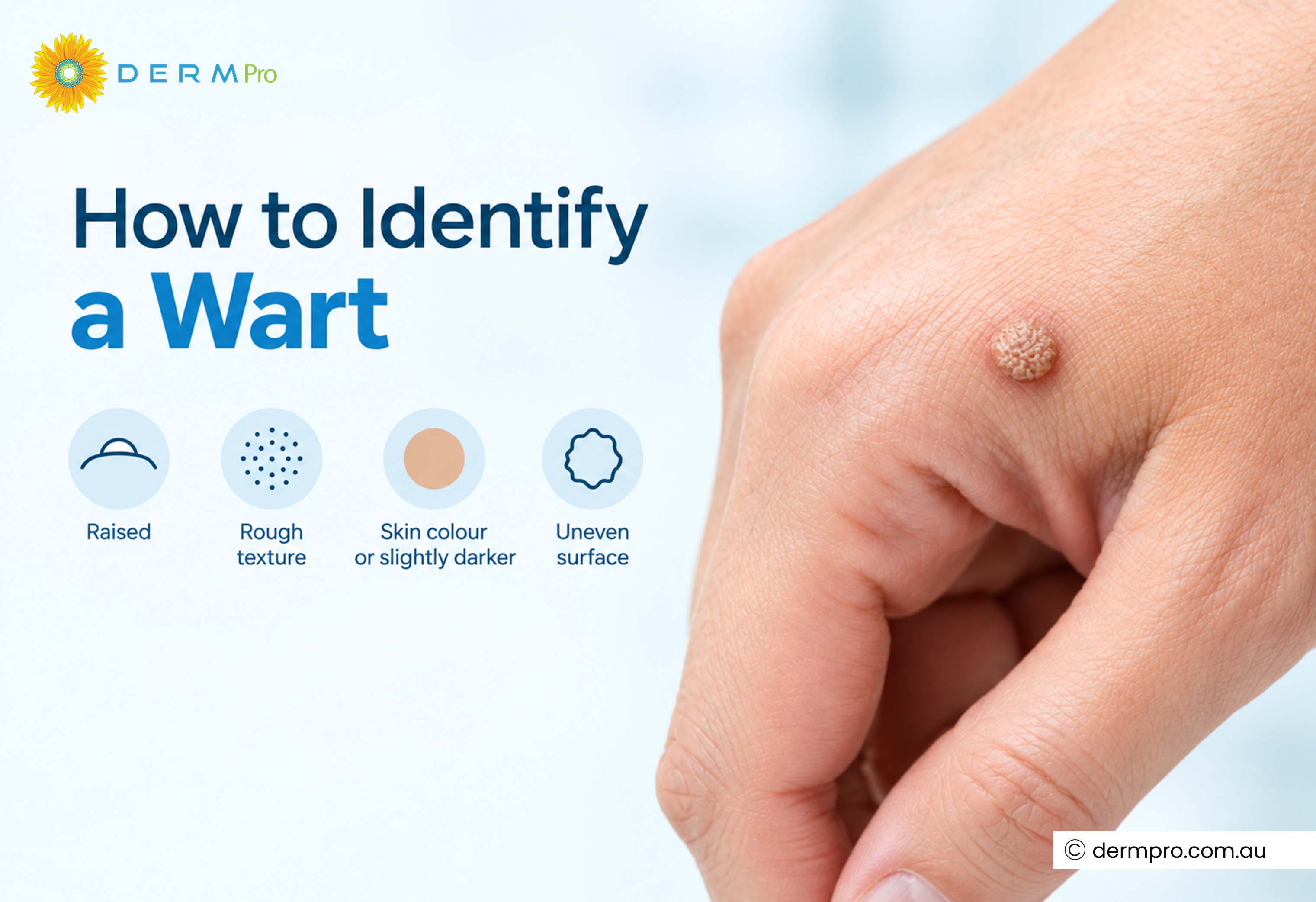 how to identify wart?