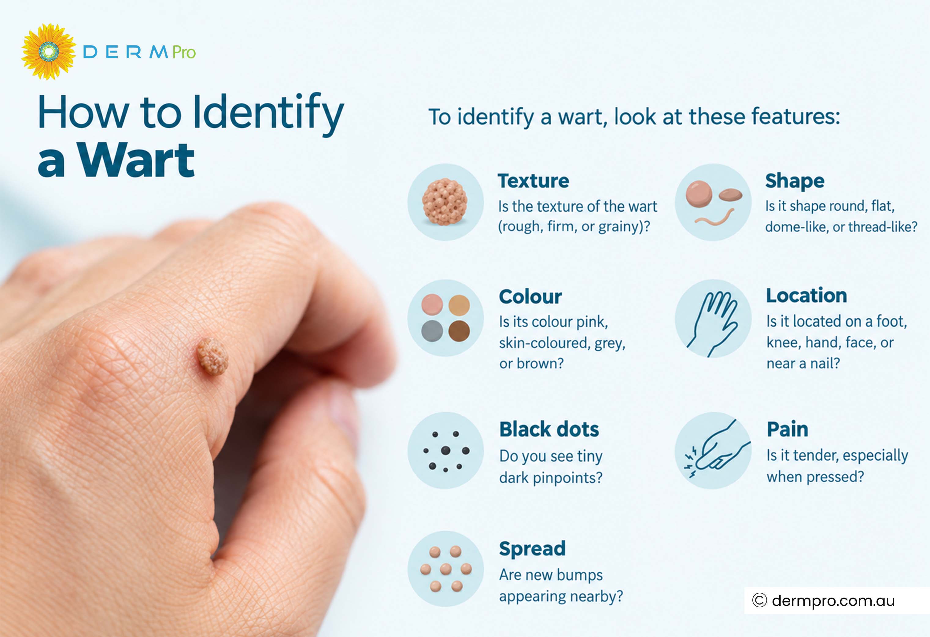 how to identify wart