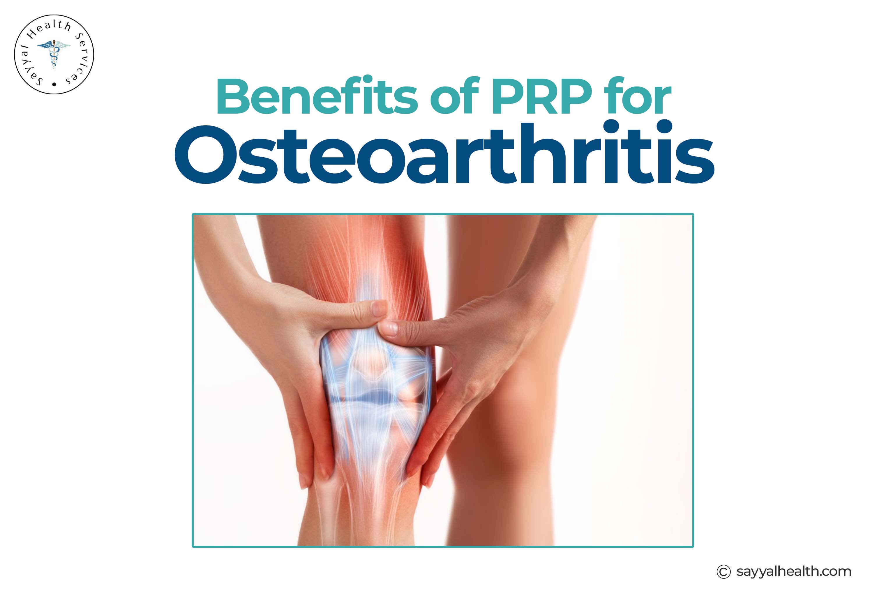 Benefits of Osteoarthritis for Joints