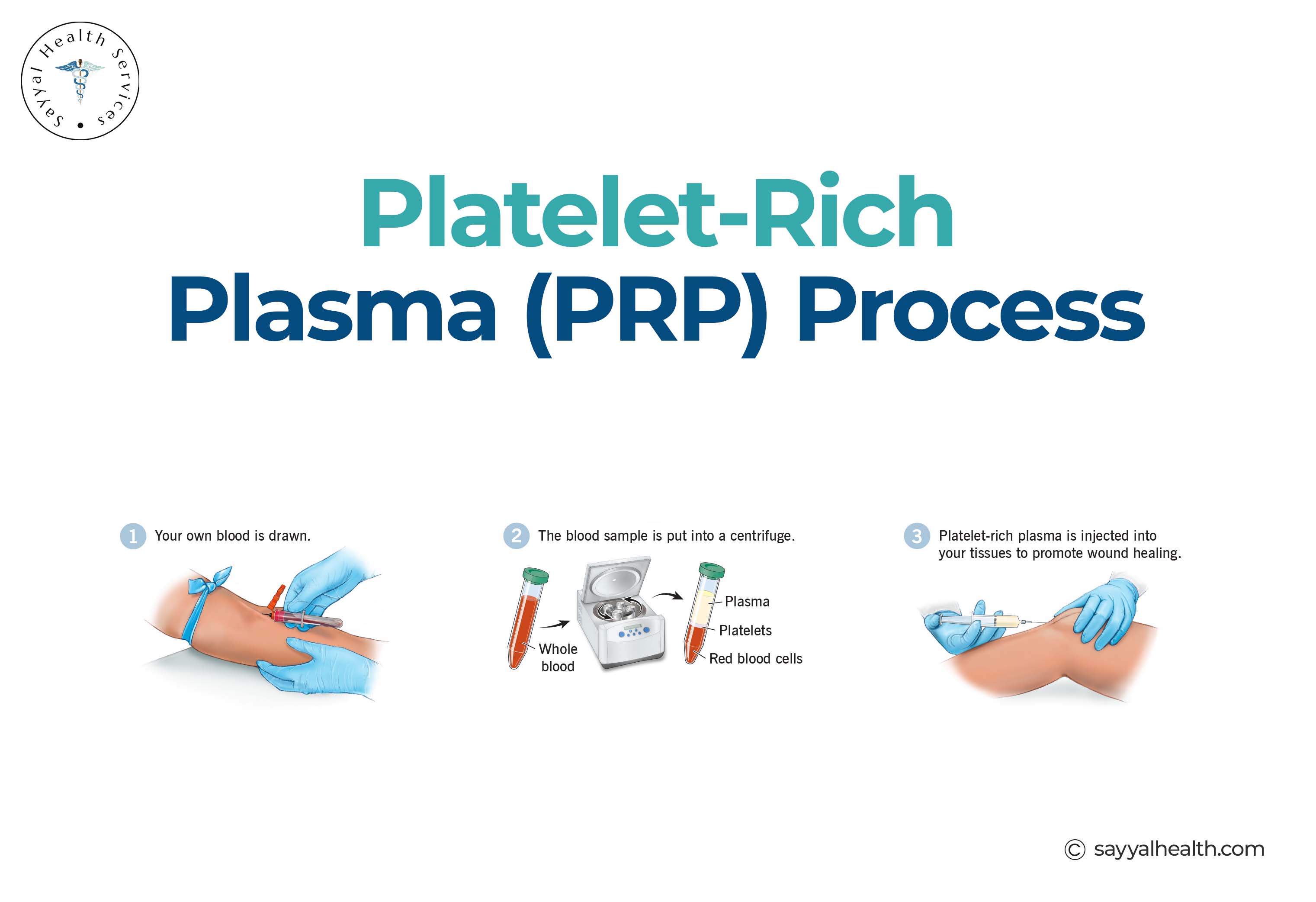 image shows the PRP injection process