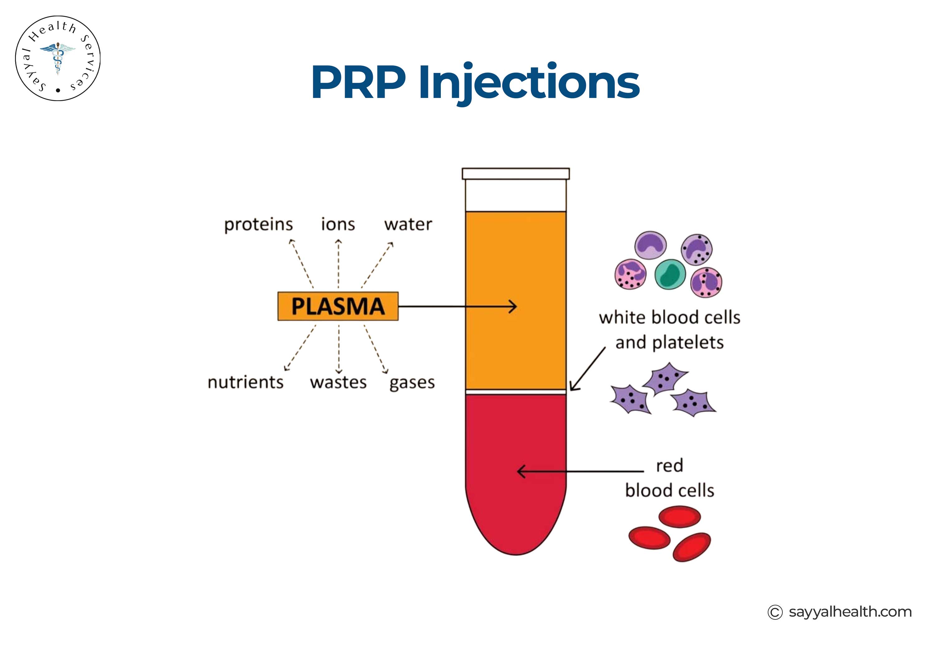 This image shows what PRP contains