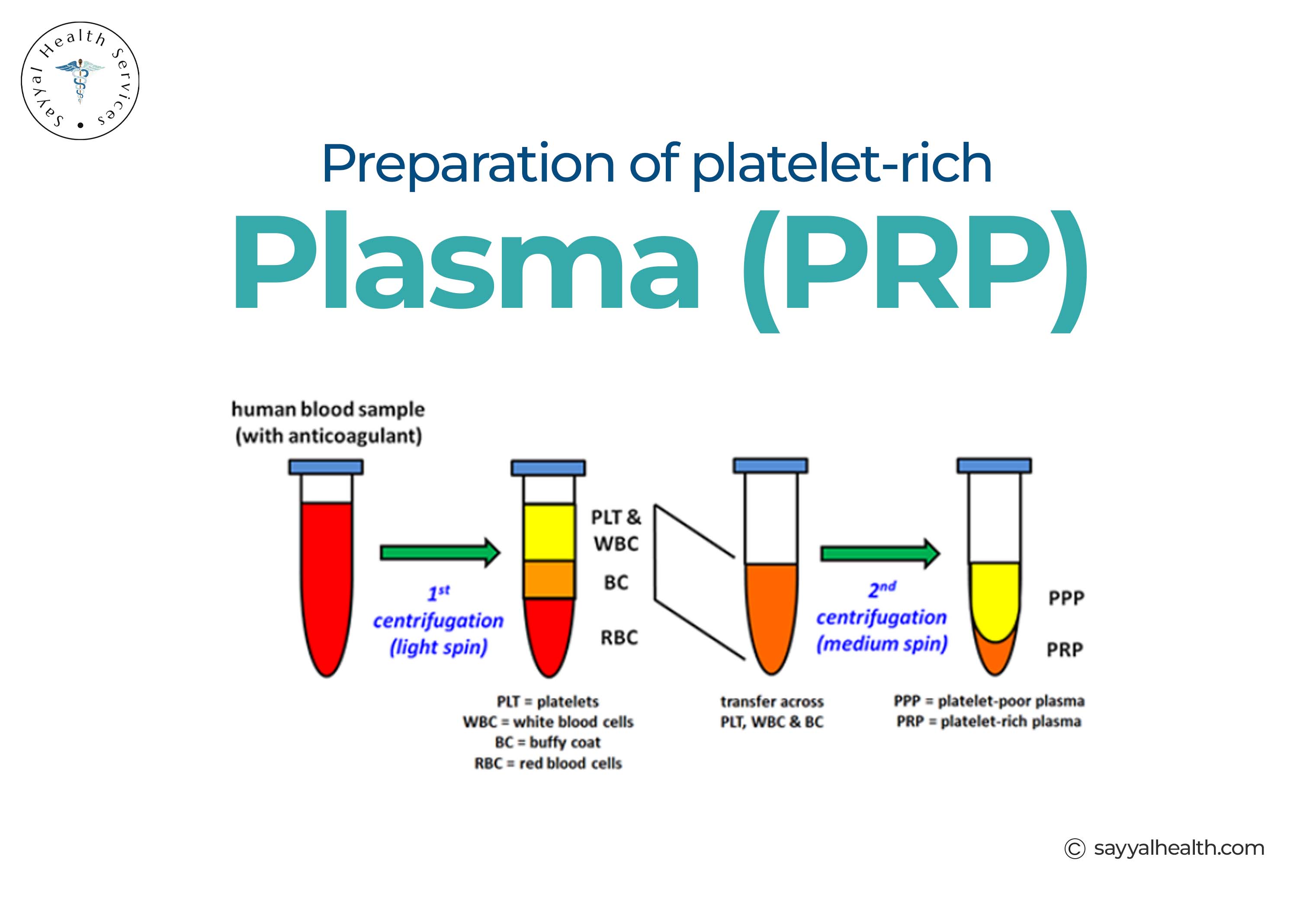 preparation of platelet rich plasma