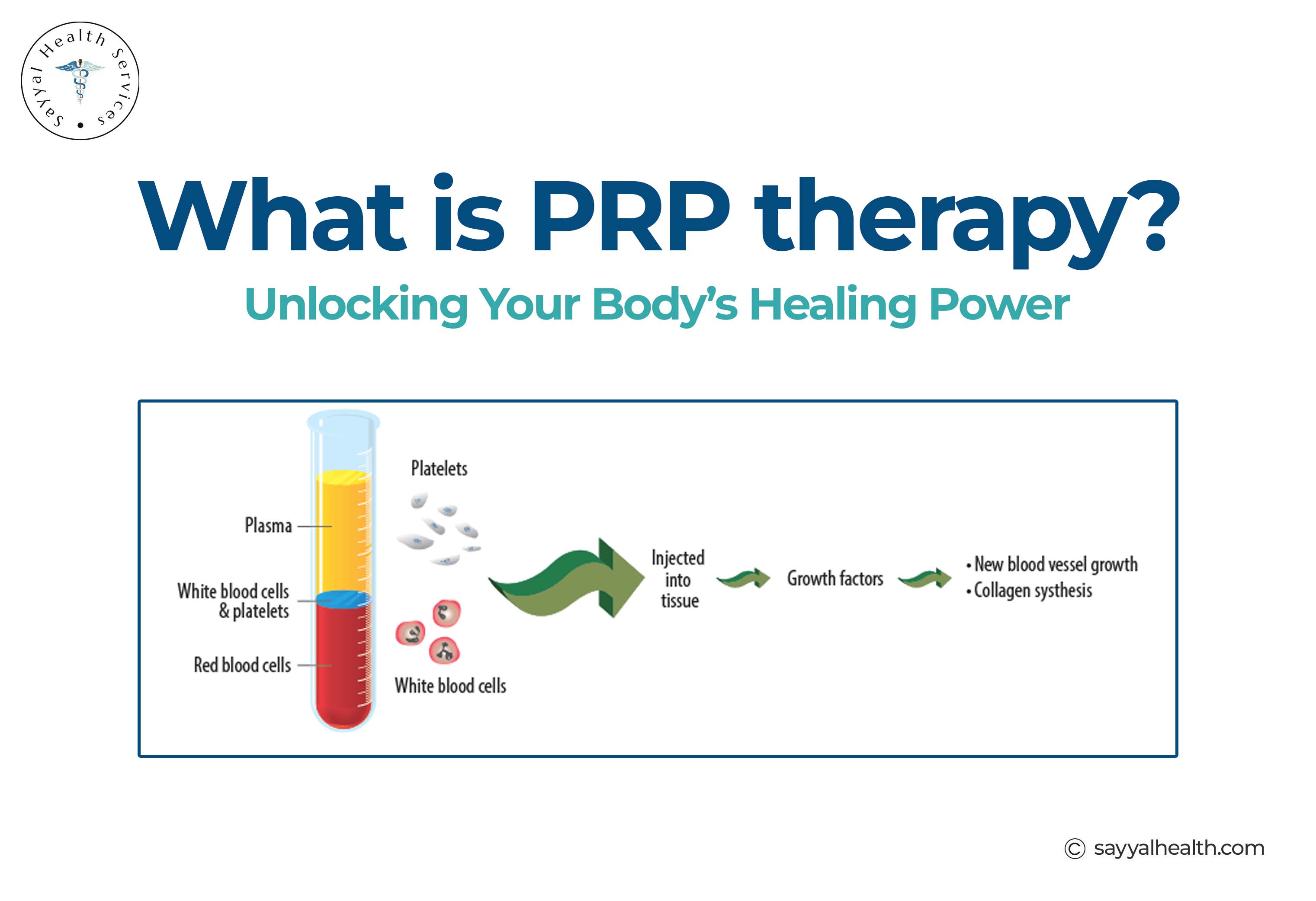 PRP therapy blood centrifugation diagram