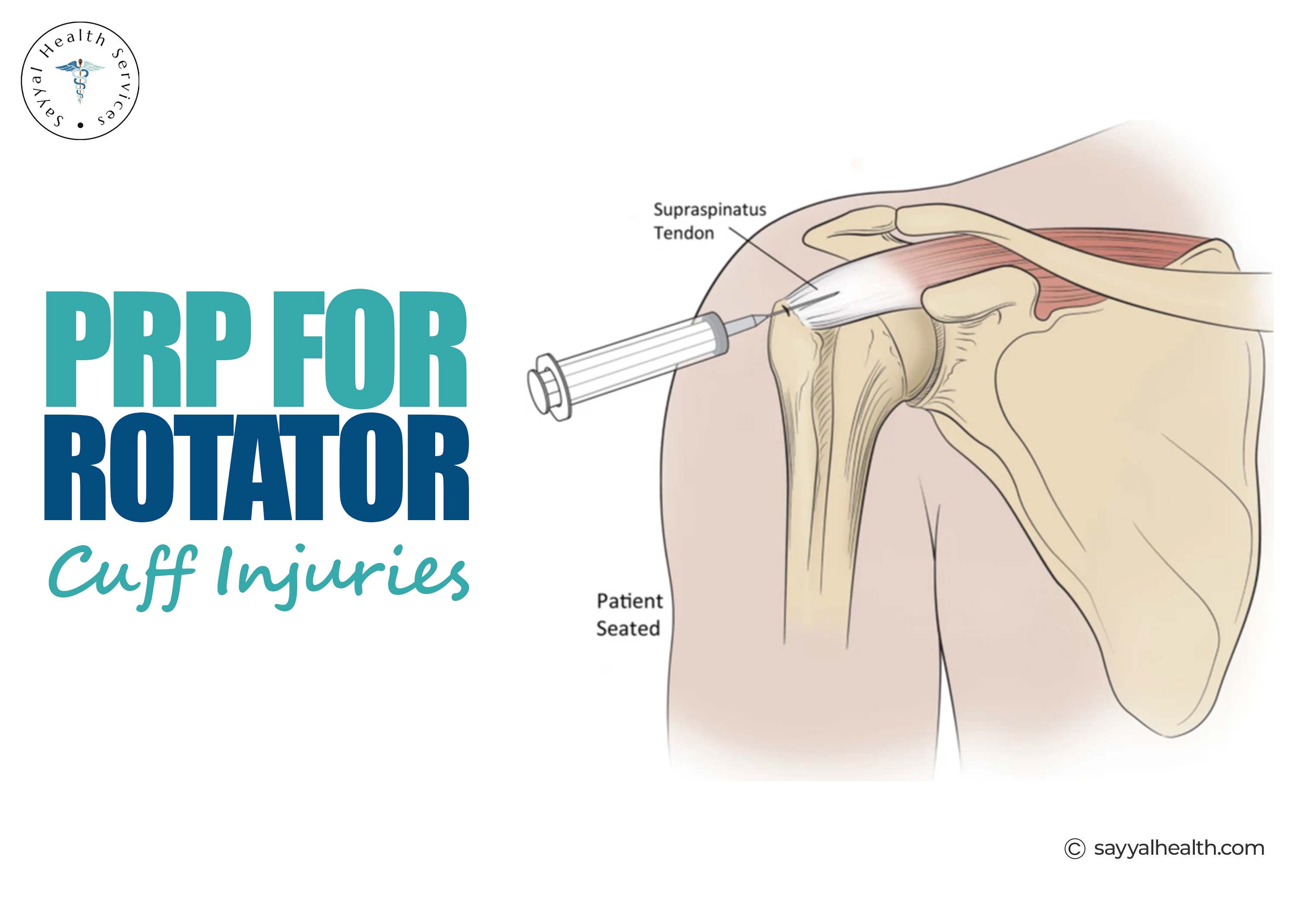 This image is about PRP for rotator cuff injury.