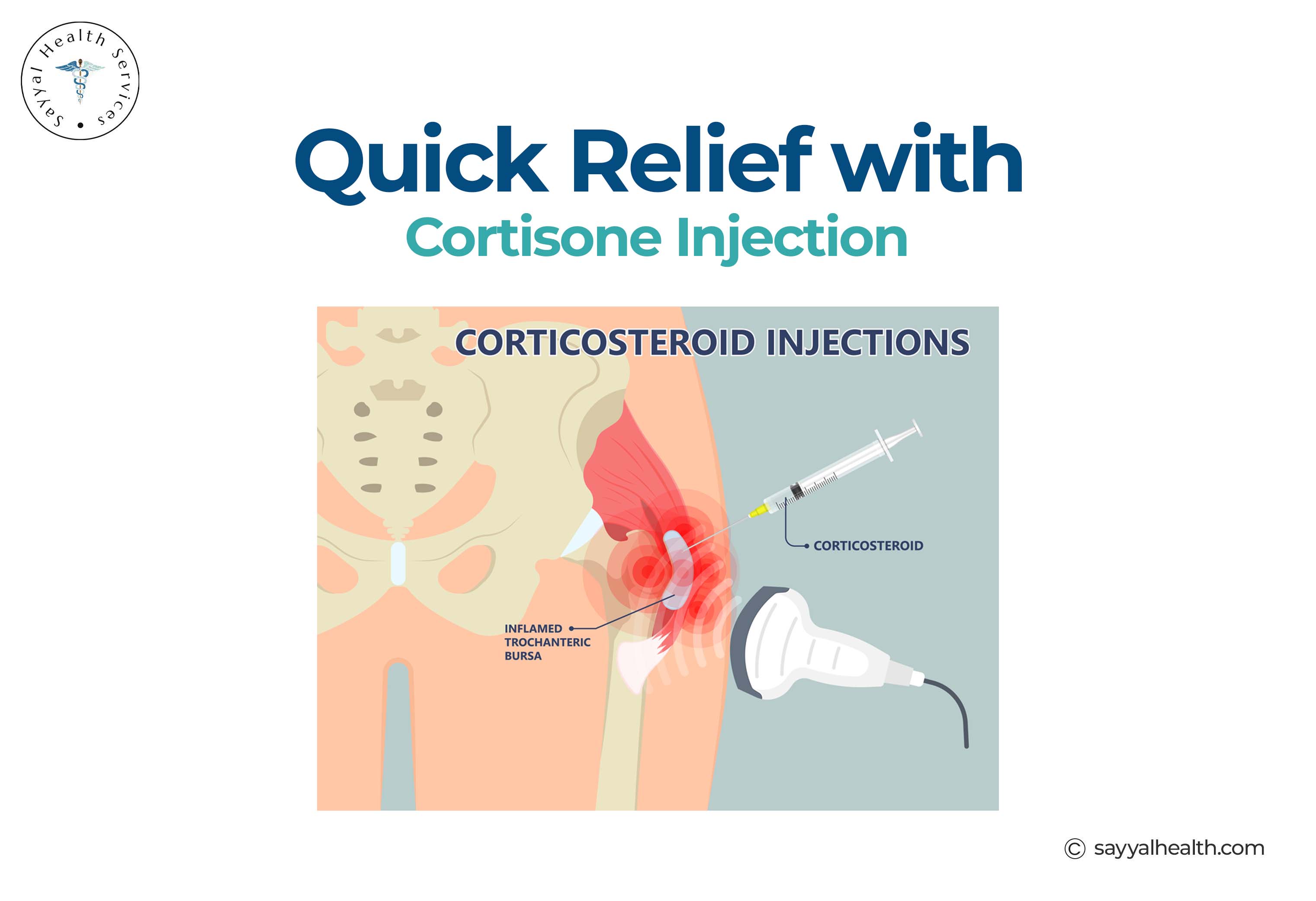 Ultrasound-guided hip corticosteroid injection