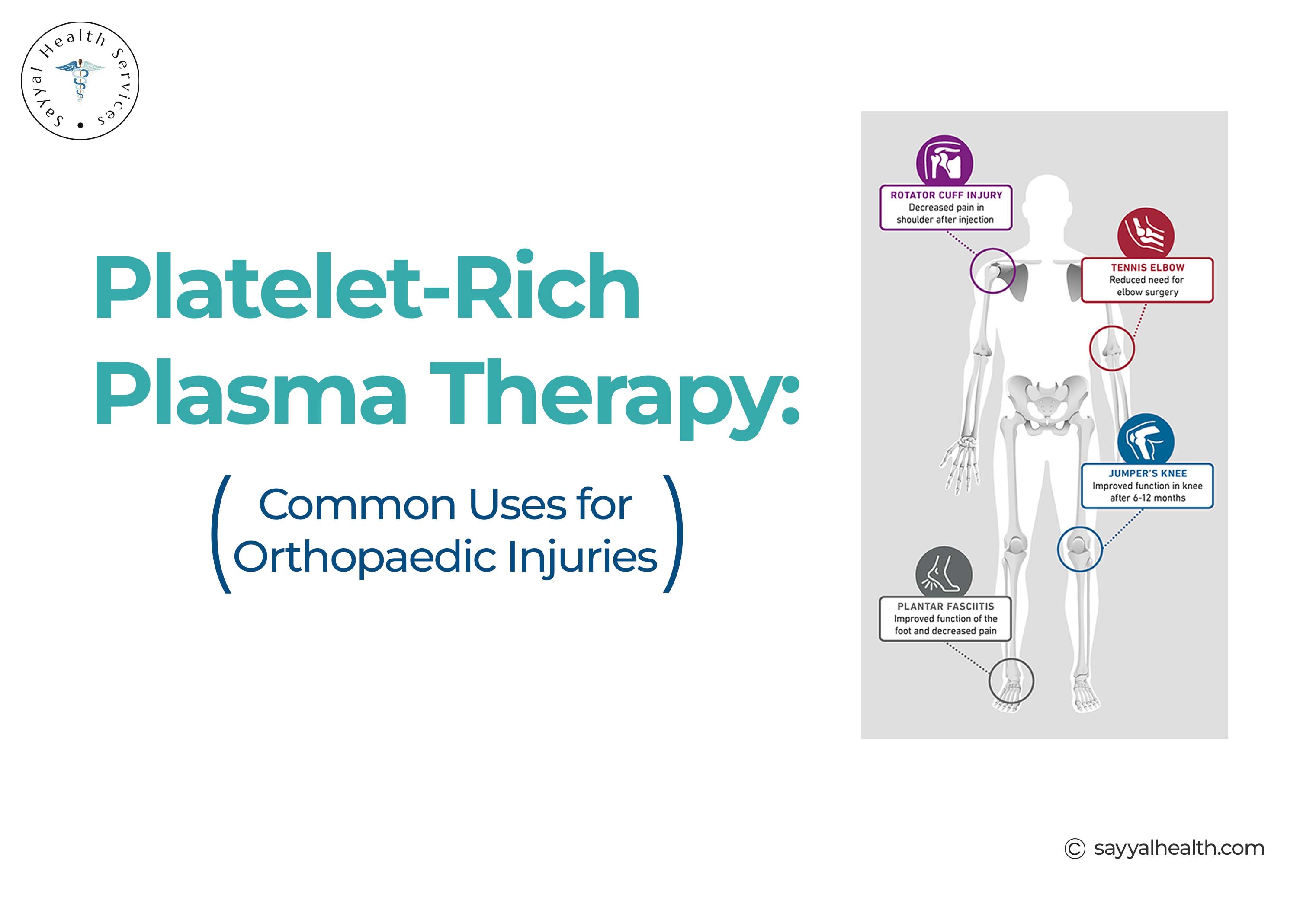 This image tells about PRP injection for Orthopedic injuries.