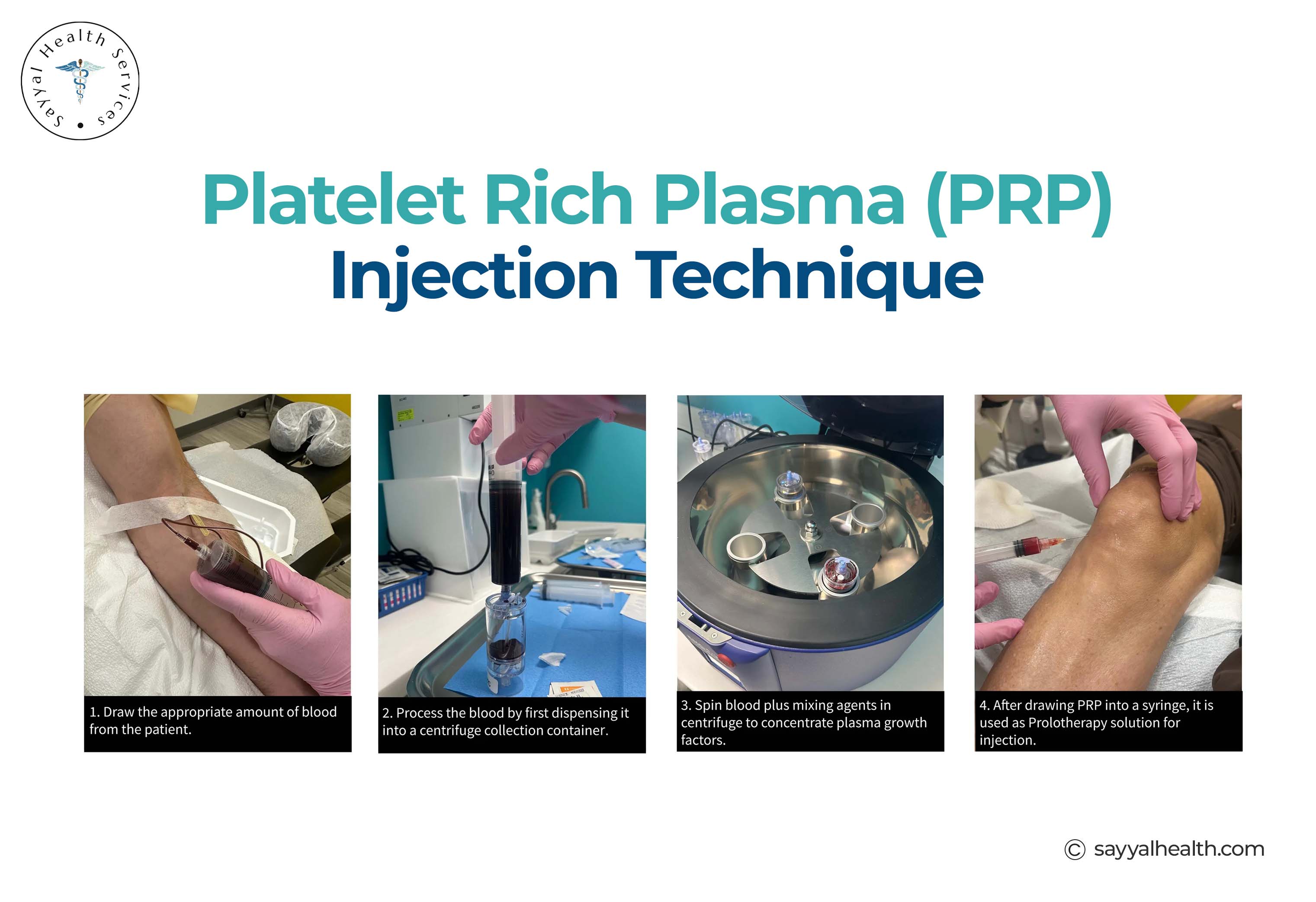 Platelet Rich Plasma Injection