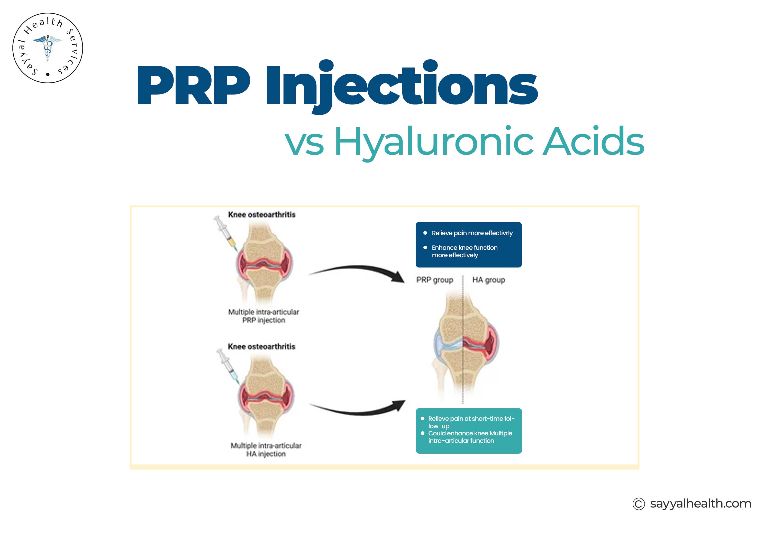 PRP injection comparison with Hyaluronic acid