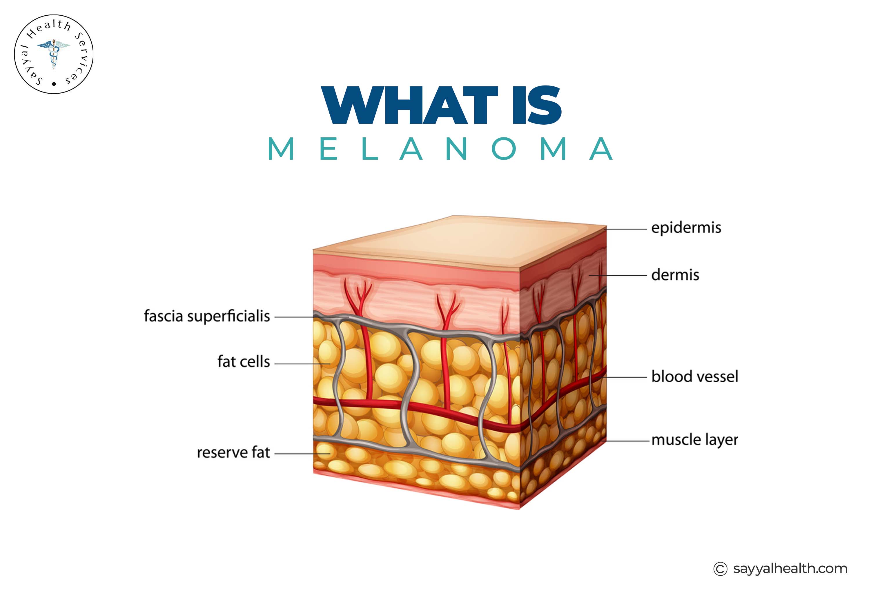 Skin layer anatomy diagram explaining what is melanoma