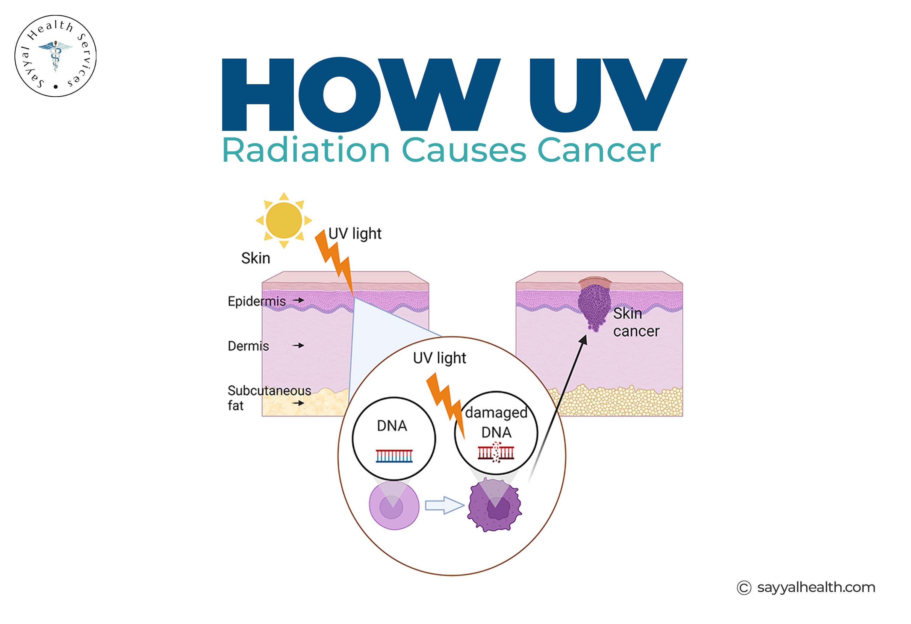 How UV radiation causes skin cancer DNA damage diagram