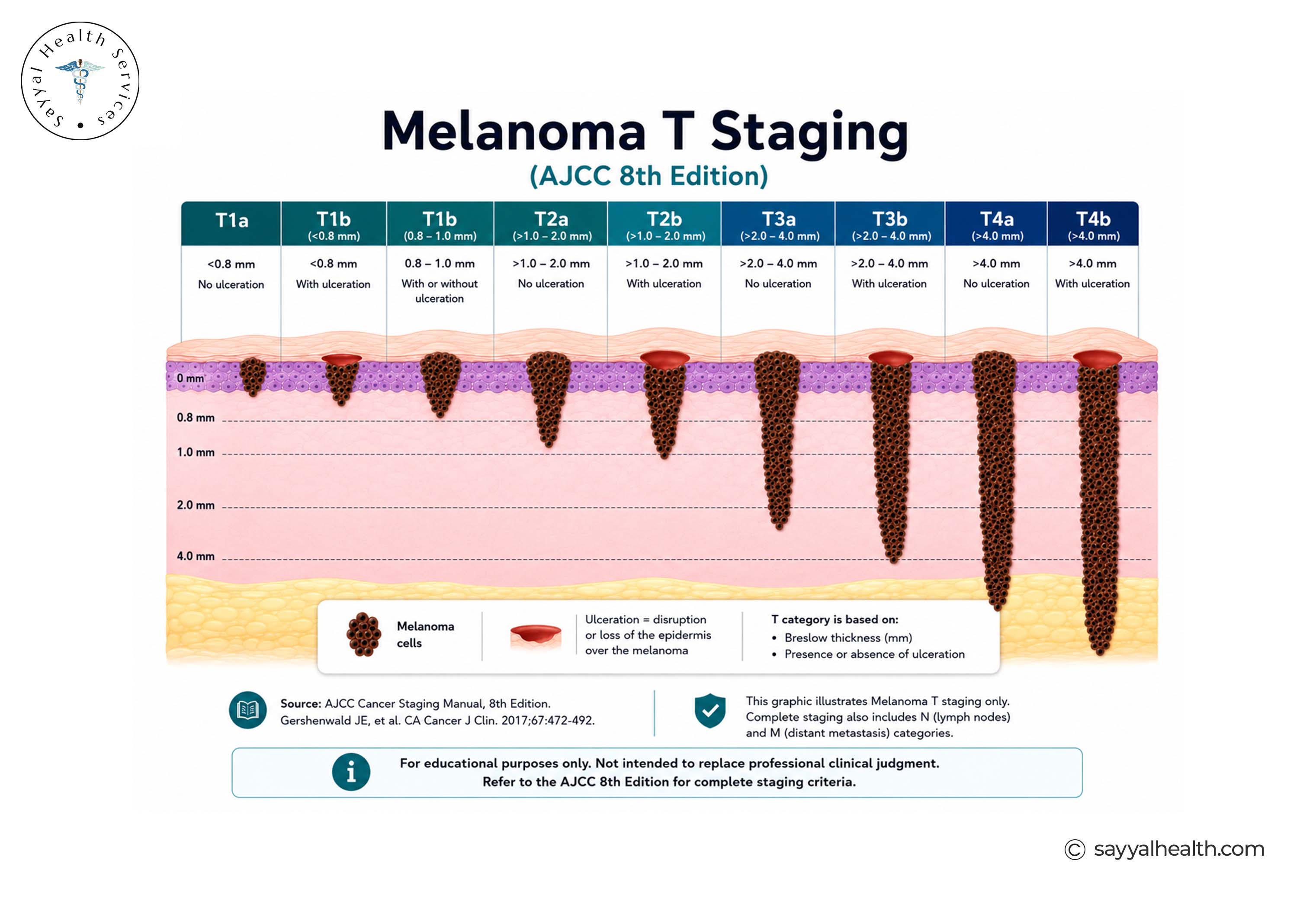 Melanoma T-Staging