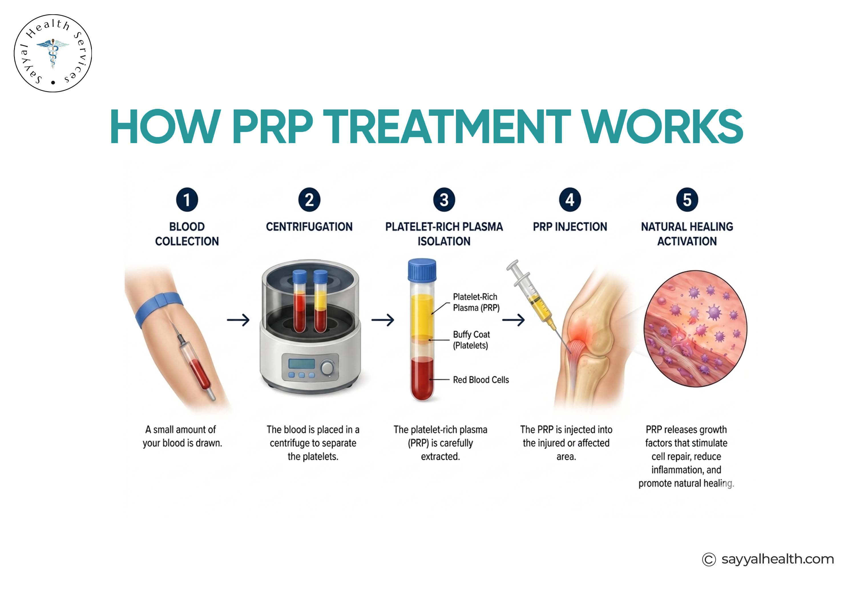 How prp treatment works