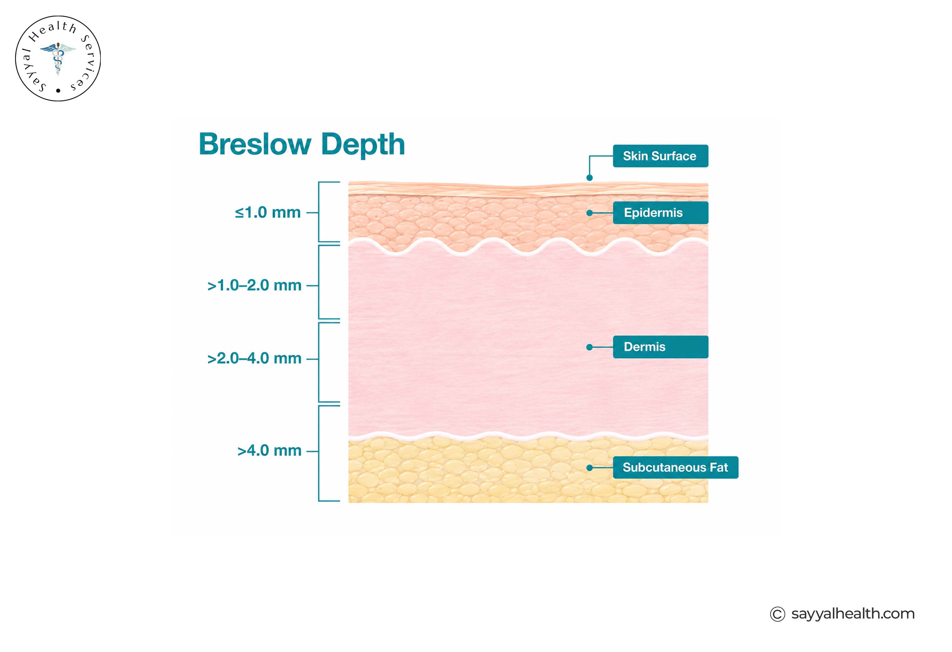Breslow depth
