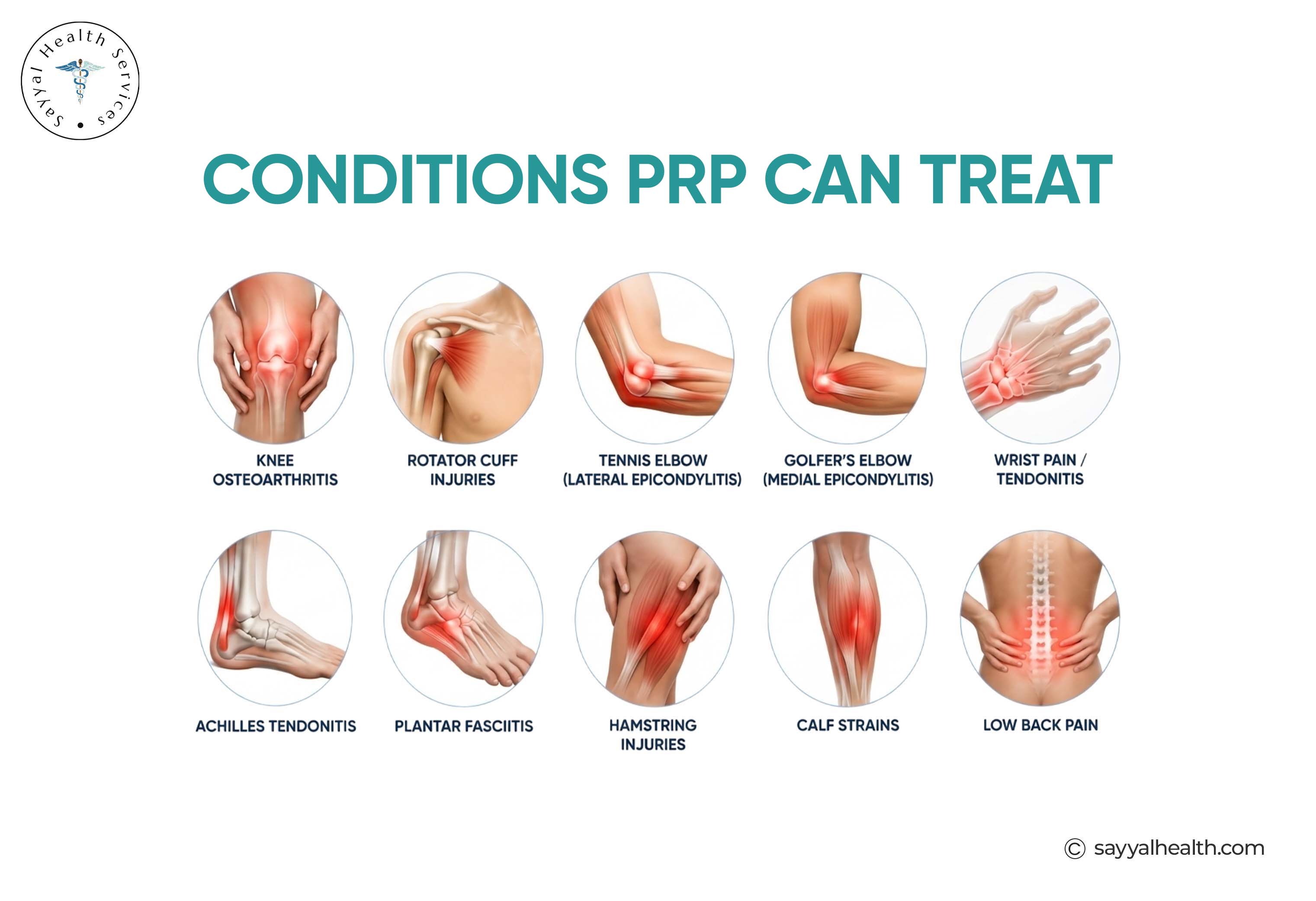 conditions prp can treat
