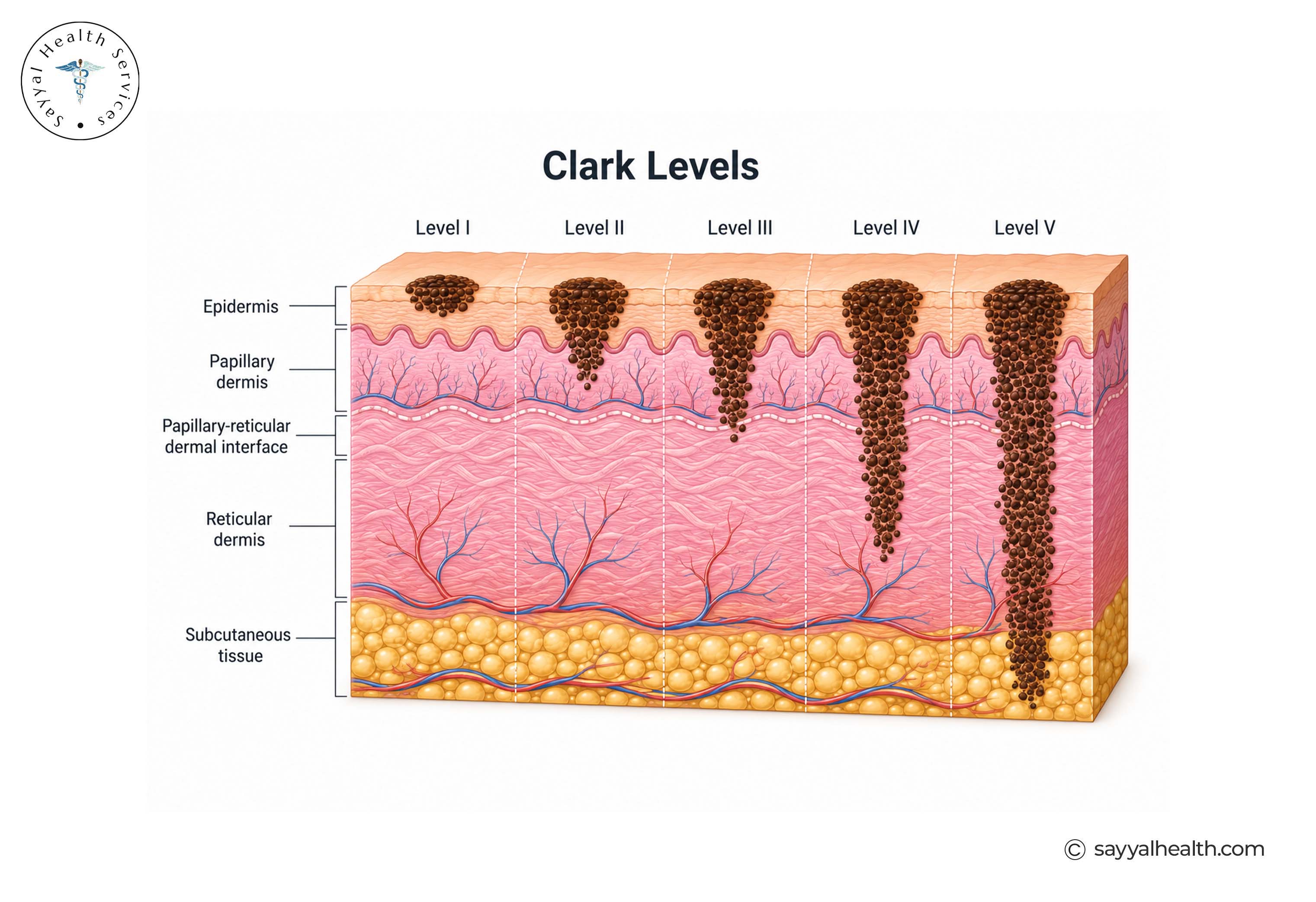 clark levels