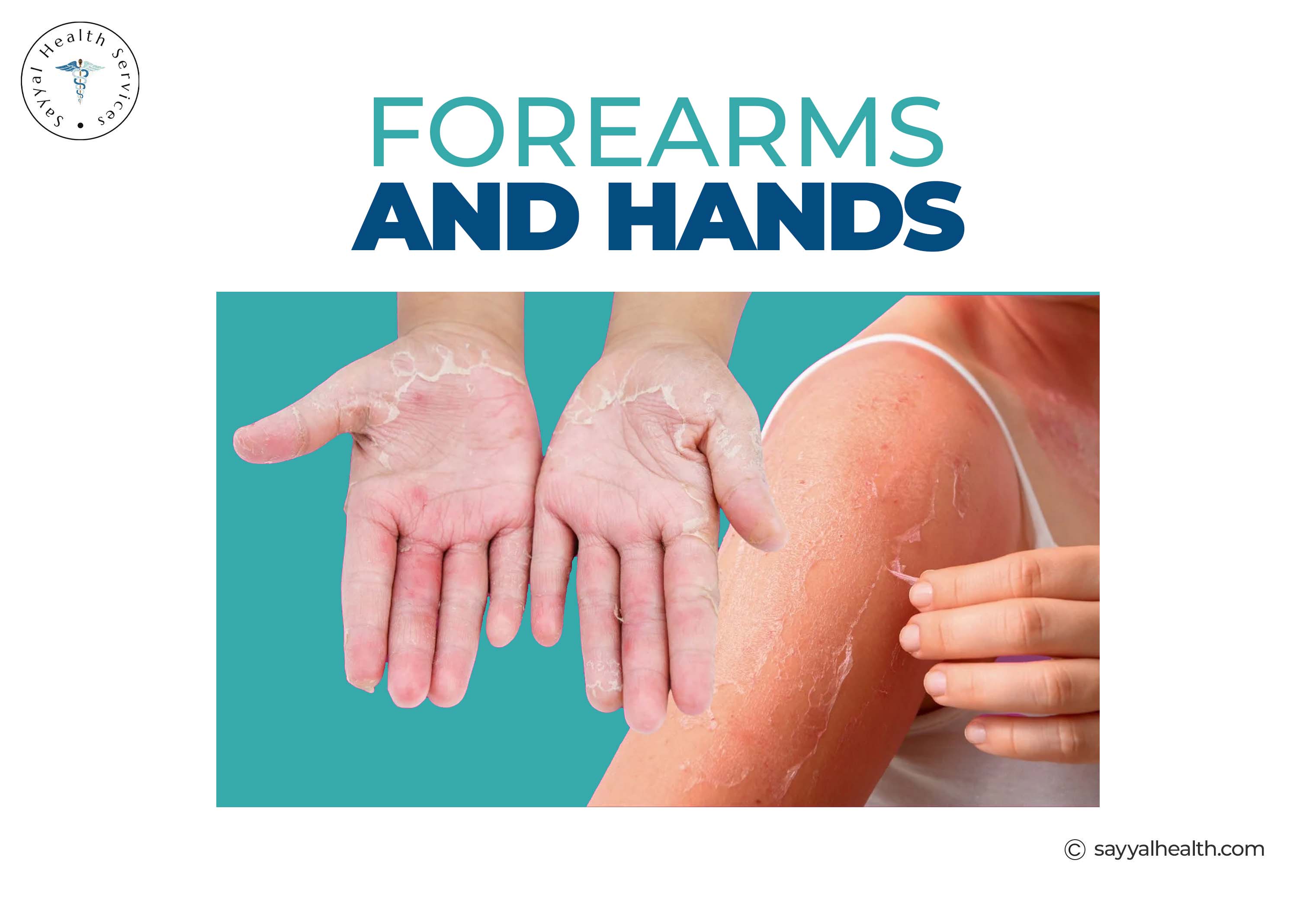 Forearms and Hands