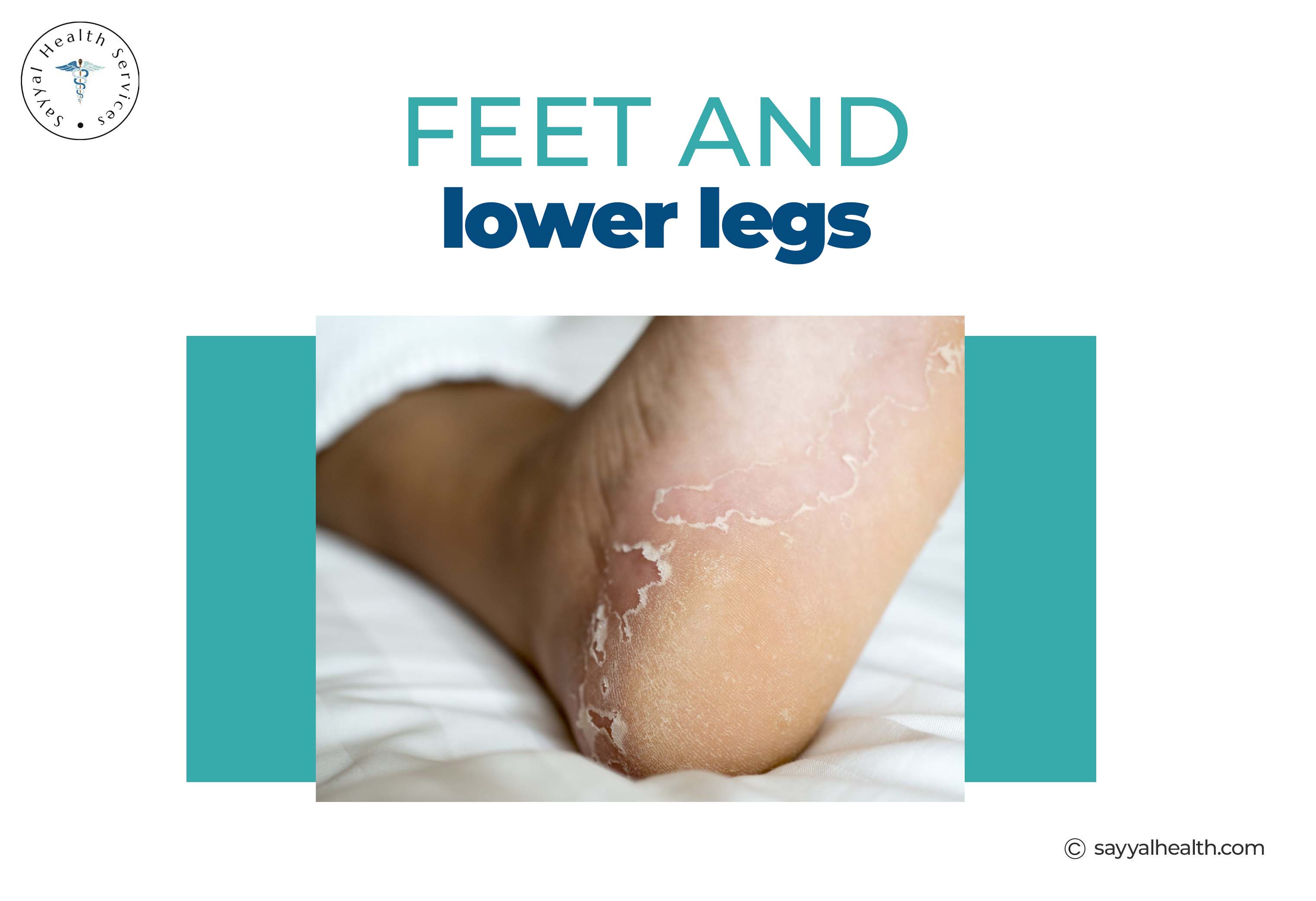 Feet and Lower Legs