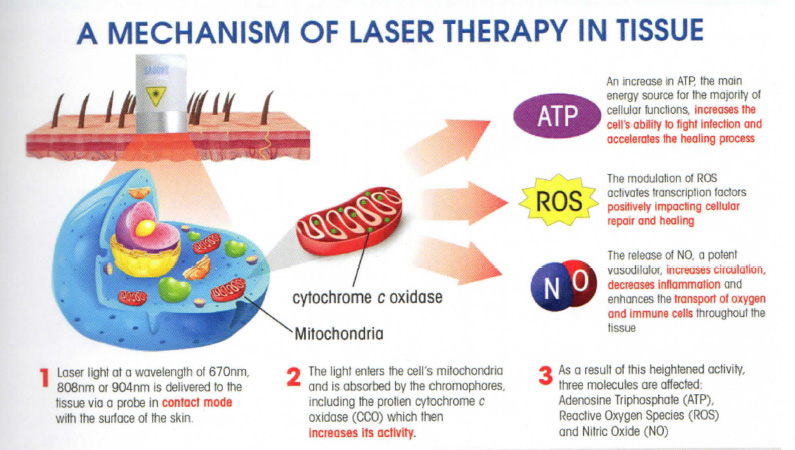 How Does Photobiomodulation Work