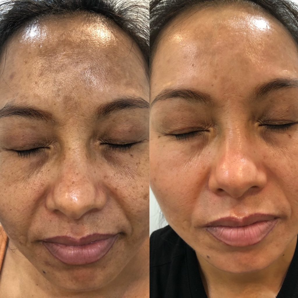 Steps in a Professional Facial