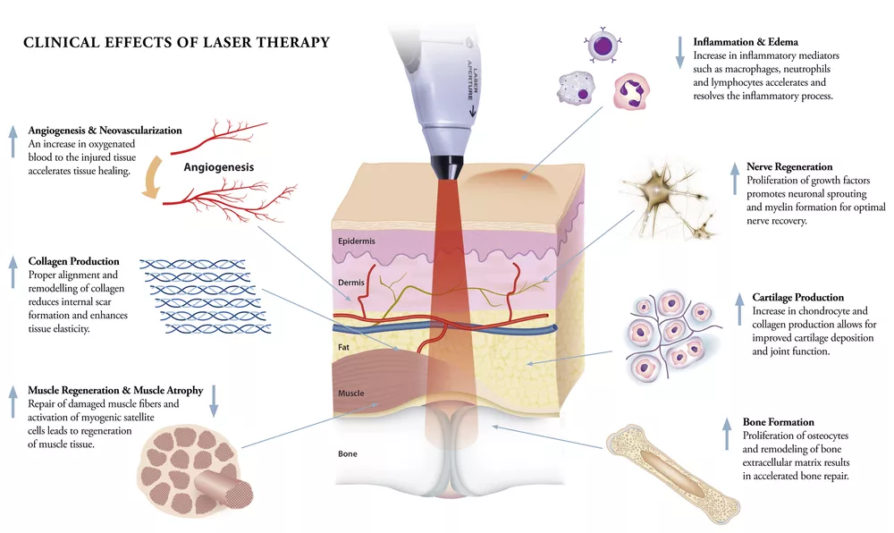 Fascination About Photobiomodulation