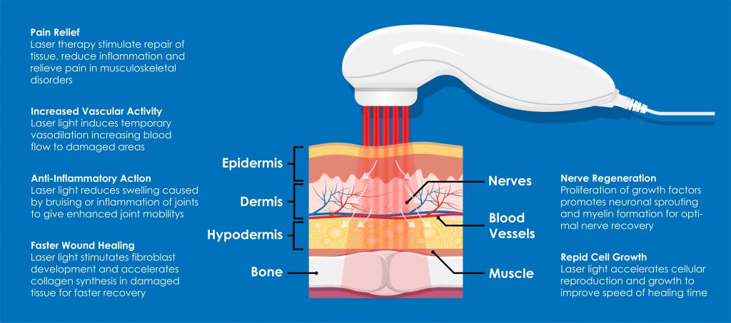 Some Known Details About Photobiomodulation 