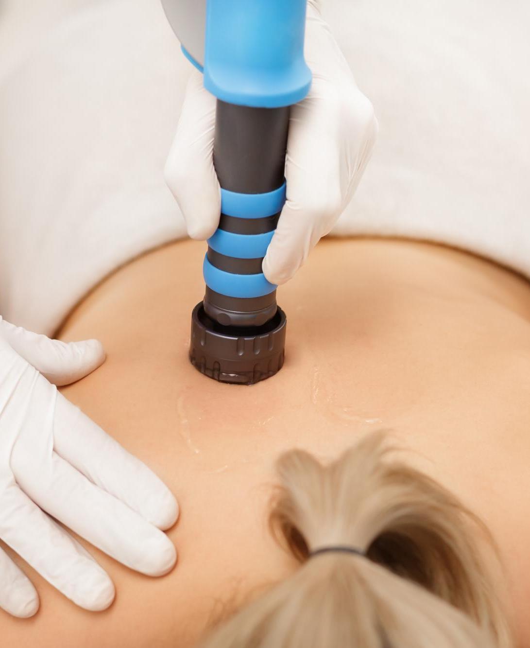 Some Known Details About Shockwave Therapy 