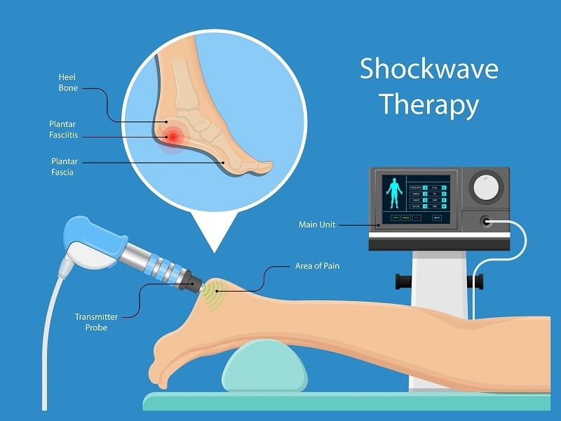 Get This Report about Shockwave Therapy
