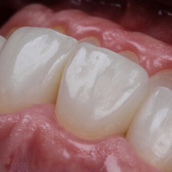 Estética dental Estética dental