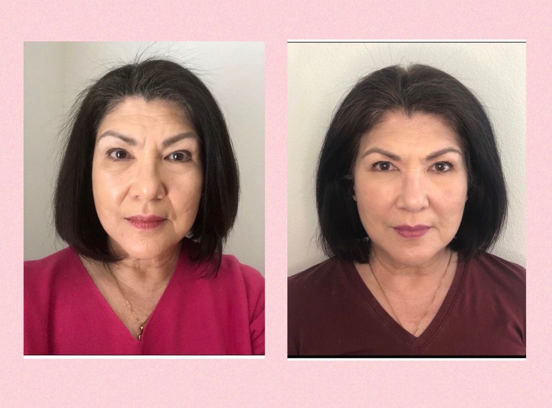 BEFORE AND AFTER RESULTS FROM FACE YOGA, BOTOX ALTERNATIVE 