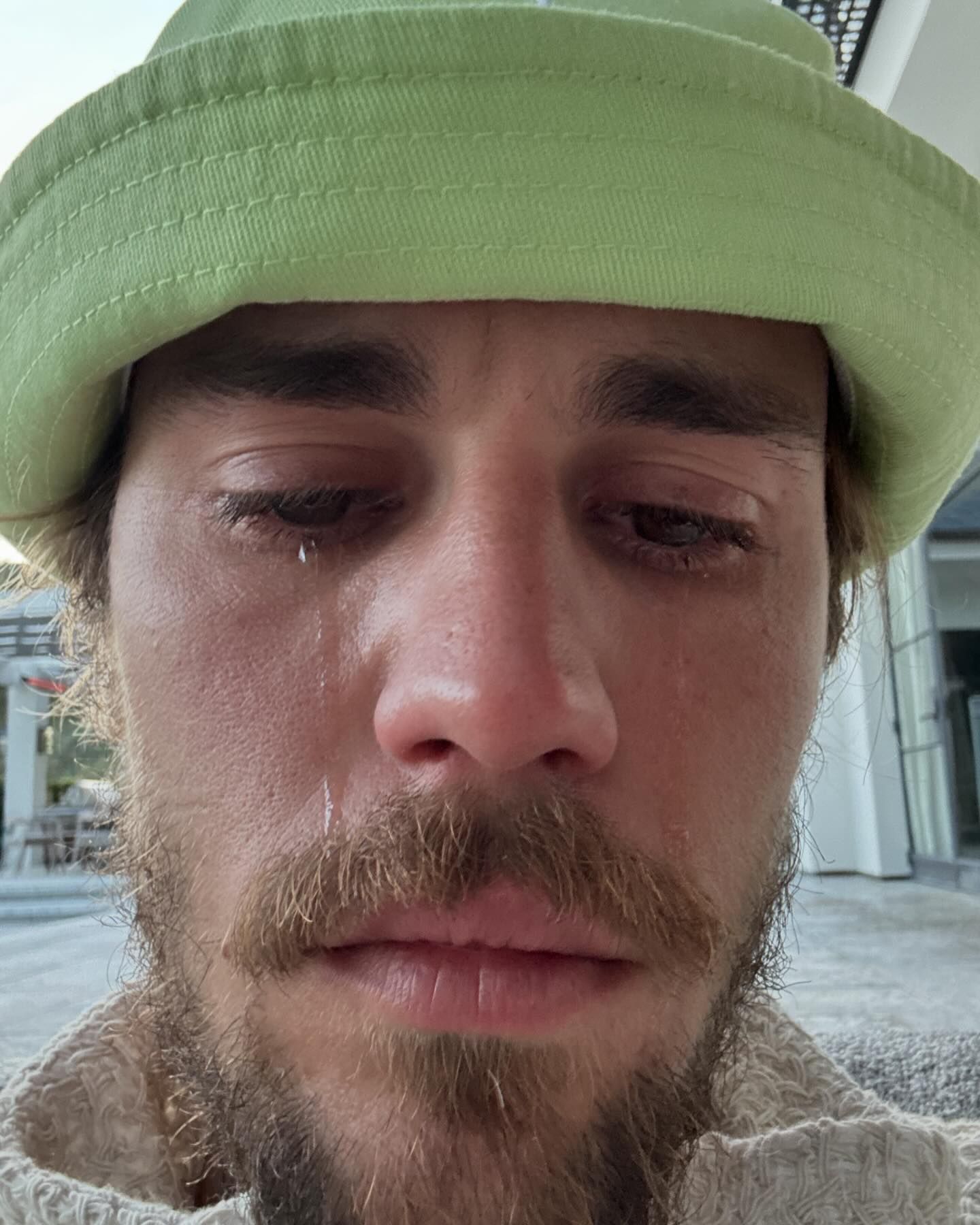 Justin Bieber shared close-up shots on Instagram showing tears rolling down his cheek