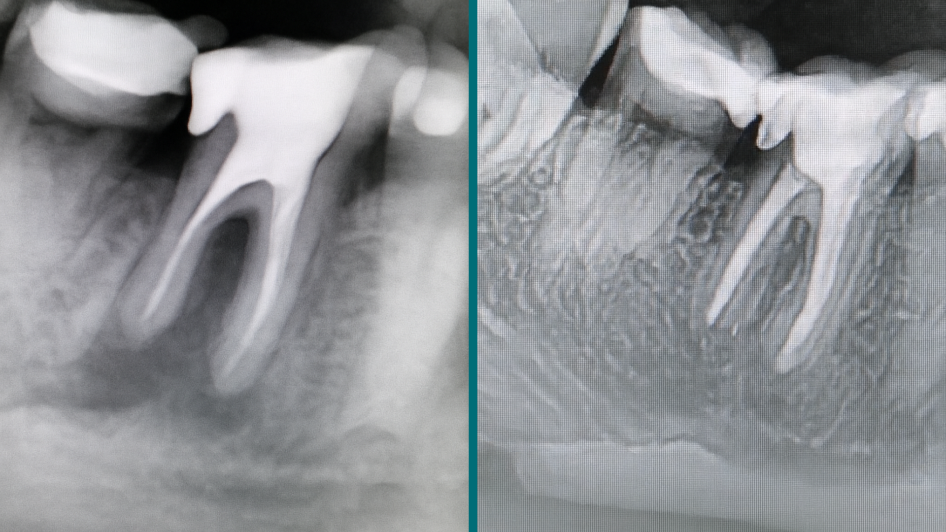 Odontología 9 - Endodoncia