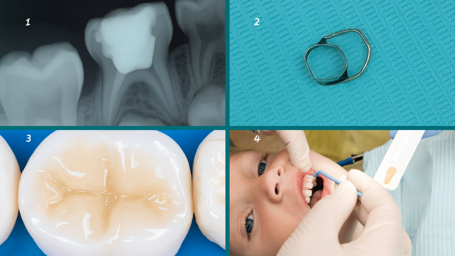 Odontología 8 - Odontopediatría