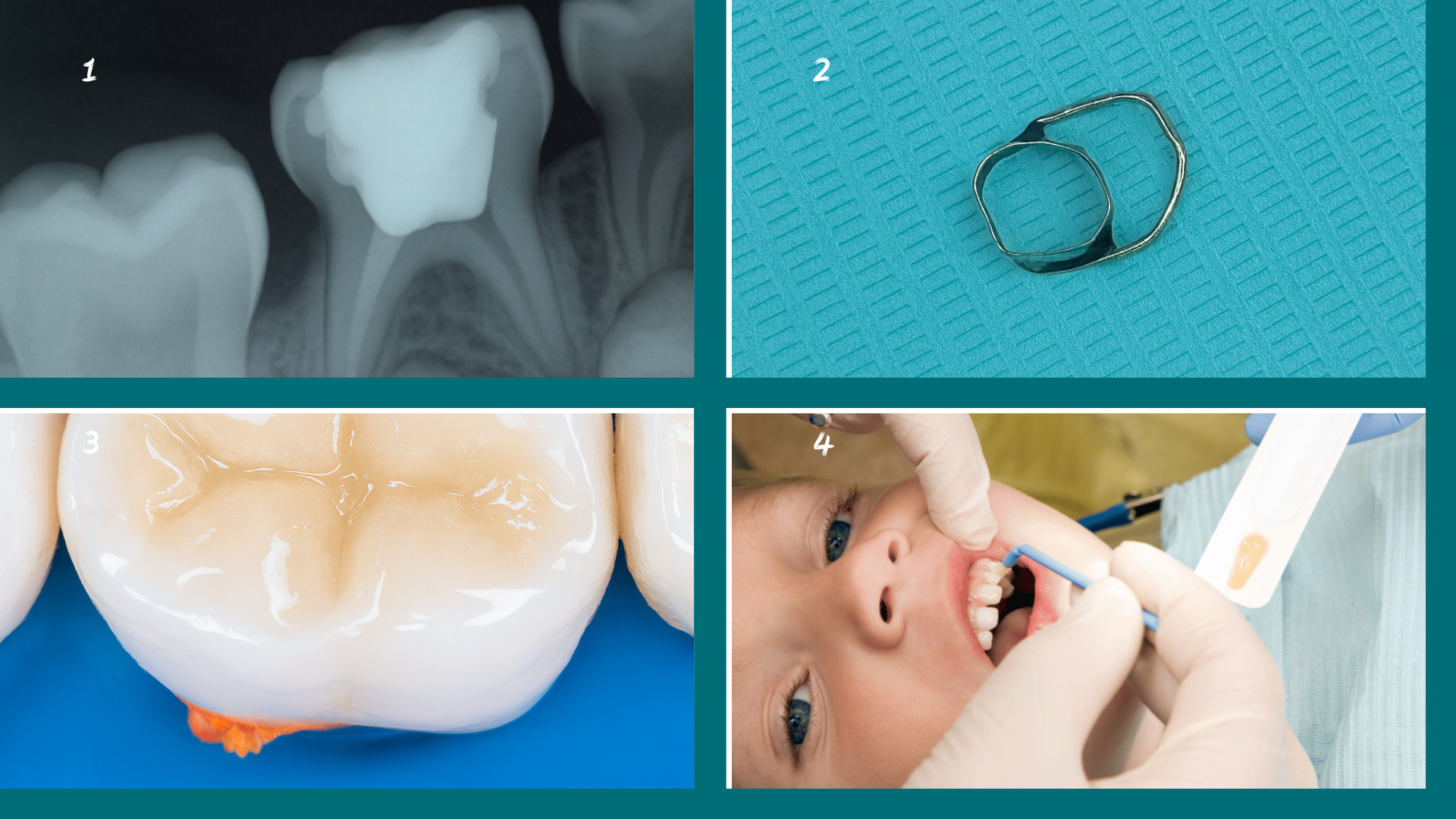 Dentisterie.8 : Dentisterie pédiatrique