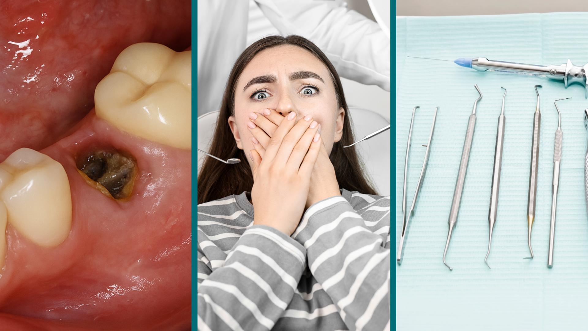 Tandheelkunde 11 - Extracties en postoperatieve instructies