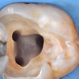 Het vormgeven van het kanaal