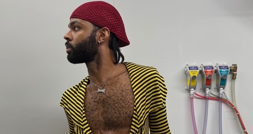 A man with a beard and a red headscarf poses in a yellow and black striped open shirt. He wears a silver necklace with a bone-shaped pendant.