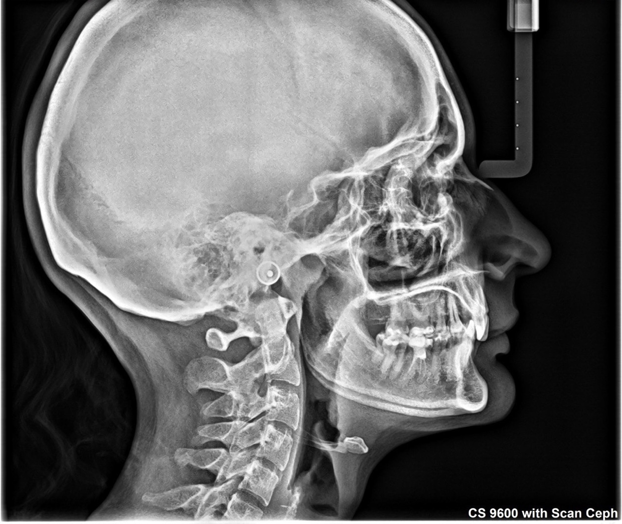 Photo by toimoiaussi_