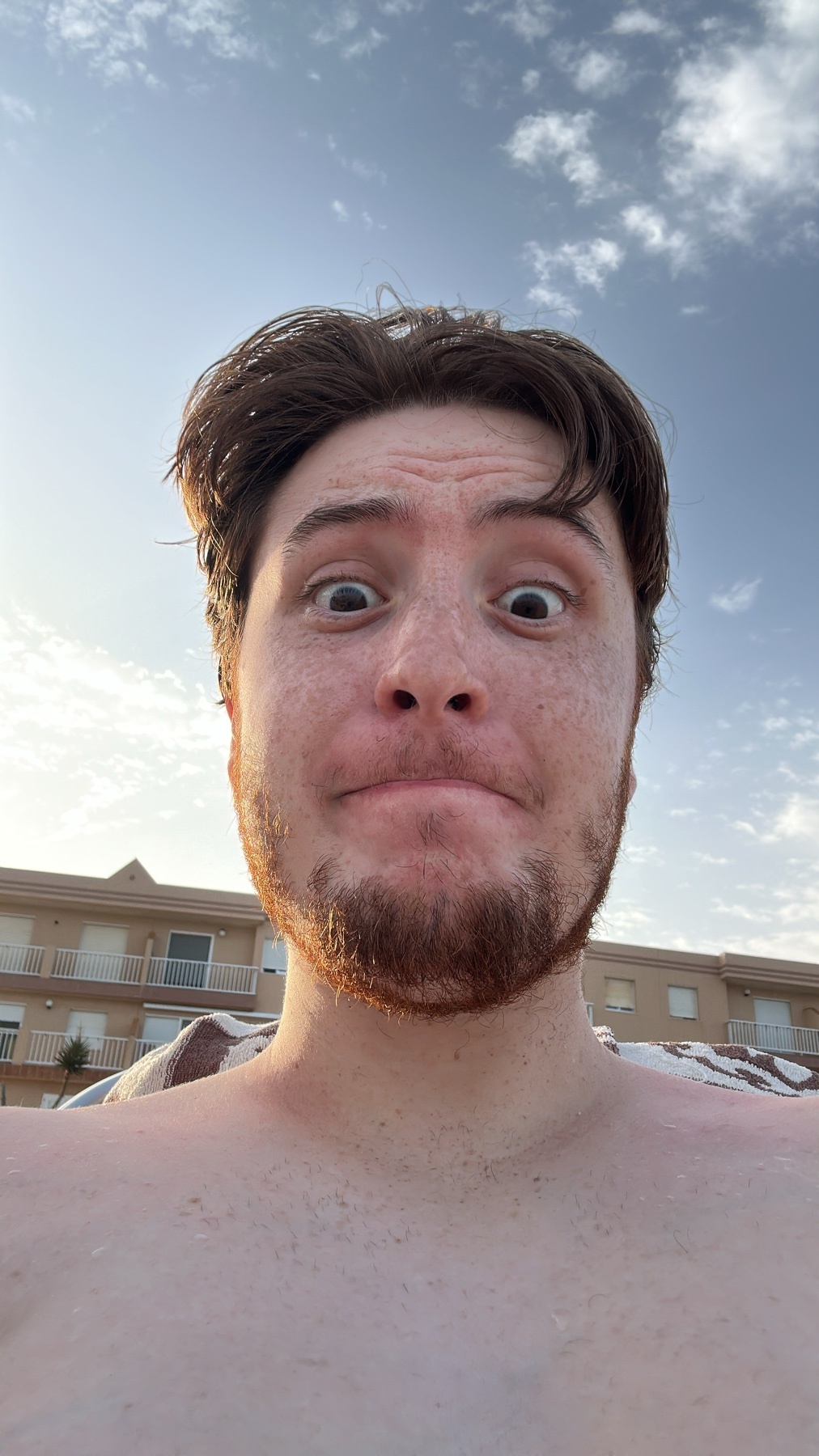 A man with freckles and stubble makes a surprised face at the camera in a selfie taken outdoors with a cloudy sky in the background.