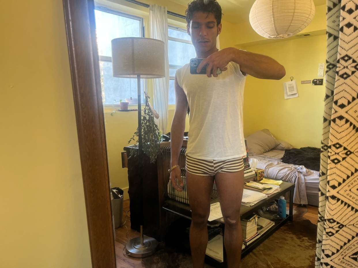 A man takes a mirror selfie in a bedroom, wearing a white t-shirt and striped underwear. He appears to have injured his knee.
