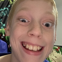 Nolansparzak