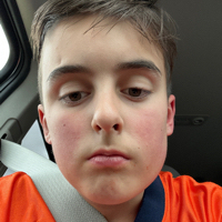 Alexander