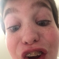 Braydon Garner