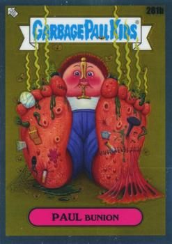 Paul Bunion