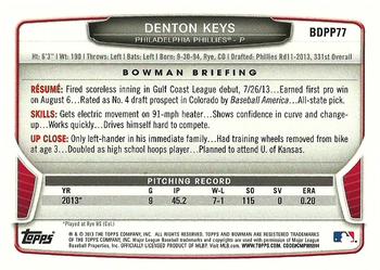 Card back
