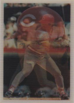 Pete Rose