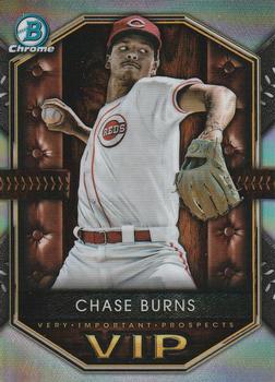 Chase Burns